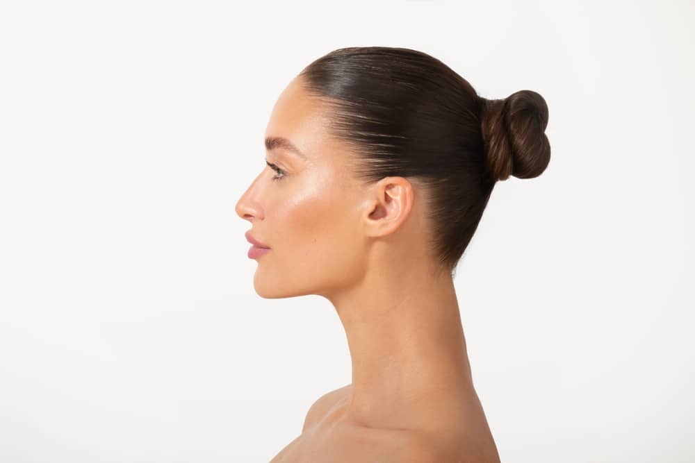 Woman after Kybella treatment in Plano, TX