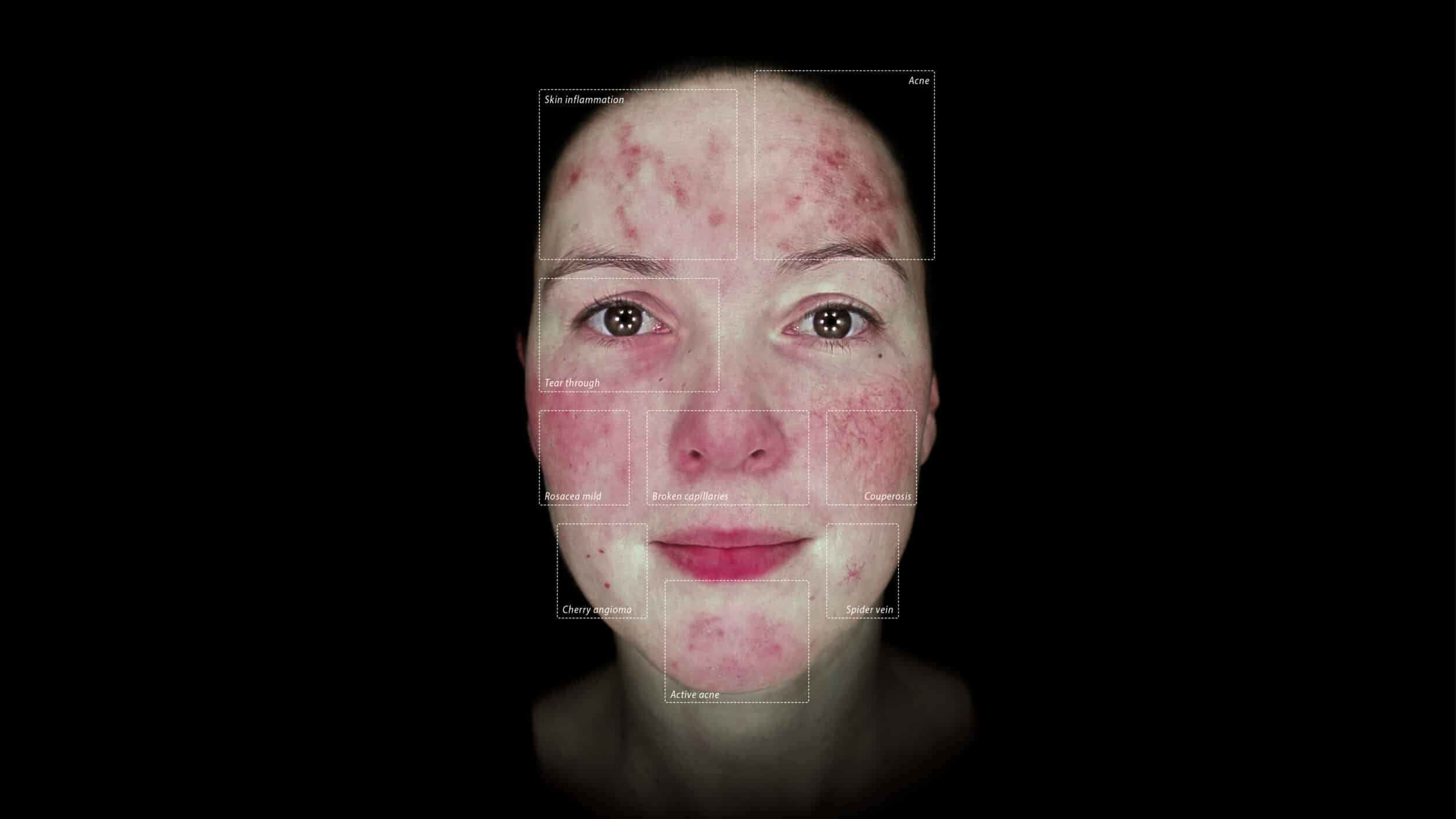 Alma IQ Vascularity Mode Callouts